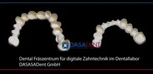 peek_teleksop_sekundaerteleskop_dental_fraeszentrum_fuer_digitale_zahntechnik