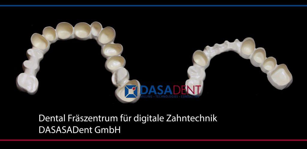 peek_teleksop_sekundaerteleskop_dental_fraeszentrum_fuer_digitale_zahntechnik